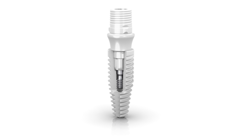 Neodent Zi Ceramic Implant System | A new mindset