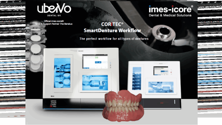 imes® smartDenture workflow – gevalideerde workflow voor alle gebitsprotheses