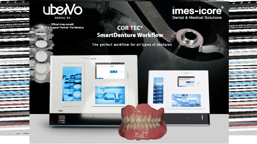 imes® smartDenture workflow – gevalideerde workflow voor alle gebitsprotheses