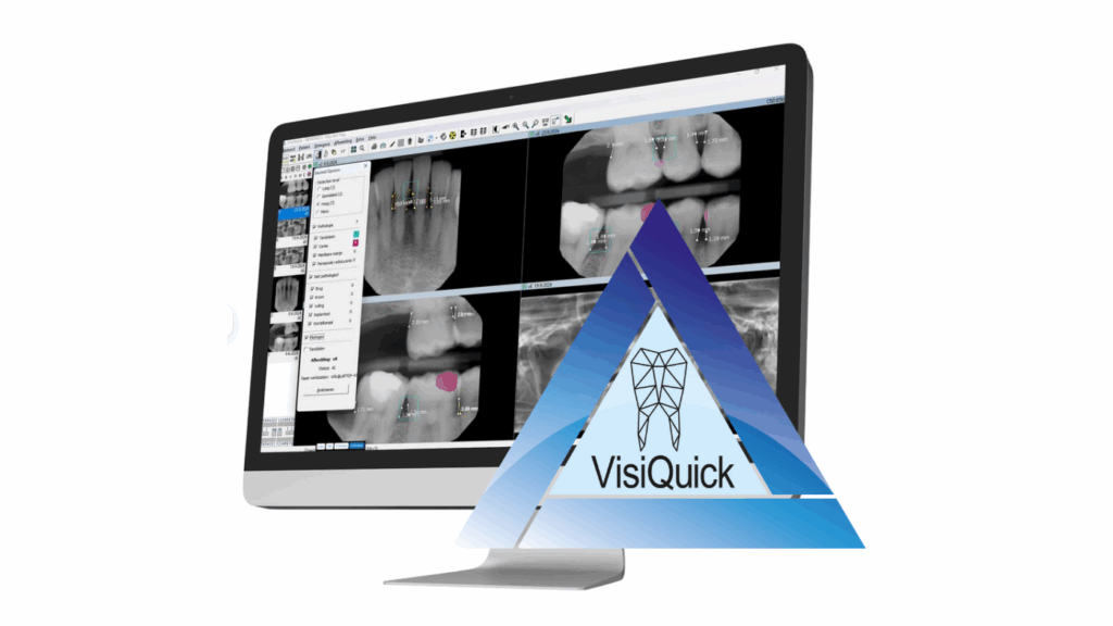 VisiQuick