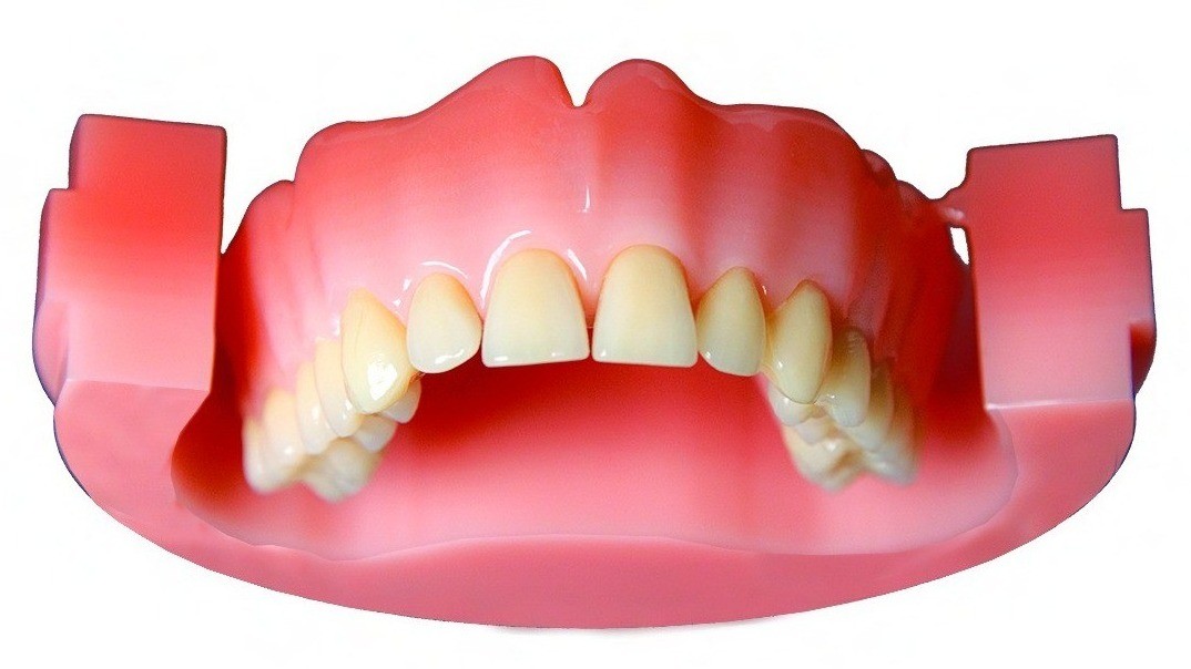PoliDent PINK CAD/CAM Disc Multilayer features layered transitional shades that mimic the natural gingival gradient. It offers a highly aesthetic, cost-effective solution for milled dentures with a more natural look and seamless color blending.