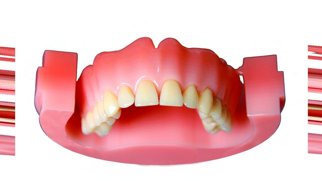 PoliDent PINK CAD/CAM Disc Multilayer features layered transitional shades that mimic the natural gingival gradient. It offers a highly aesthetic, cost-effective solution for milled dentures with a more natural look and seamless color blending.