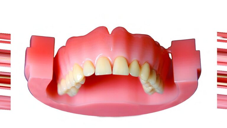 PoliDent PINK CAD/CAM Disc Multilayer features layered transitional shades that mimic the natural gingival gradient. It offers a highly aesthetic, cost-effective solution for milled dentures with a more natural look and seamless color blending.