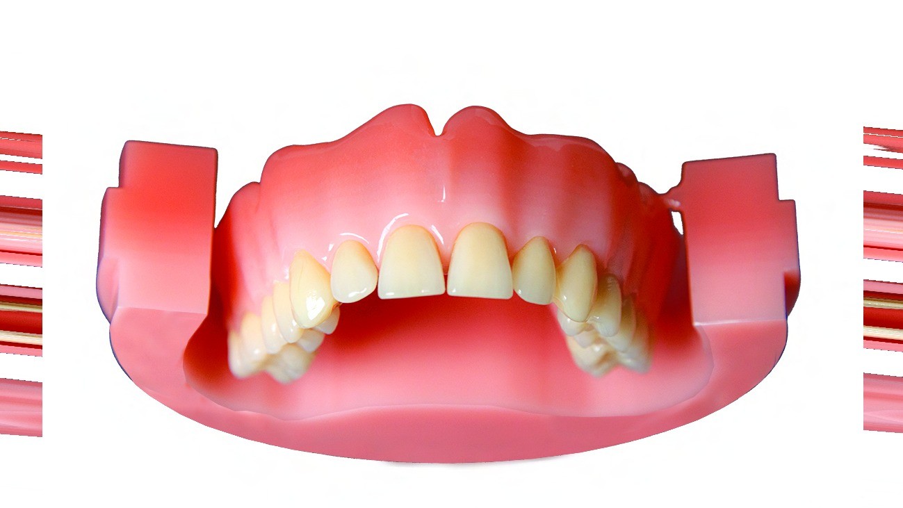 PoliDent PINK CAD/CAM Disc Multilayer features layered transitional shades that mimic the natural gingival gradient. It offers a highly aesthetic, cost-effective solution for milled dentures with a more natural look and seamless color blending.