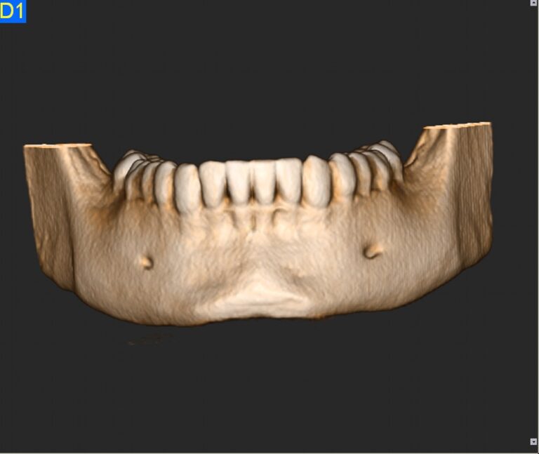 Opleiding CBCT Toezichthoudend Medewerker Stralingsbescherming