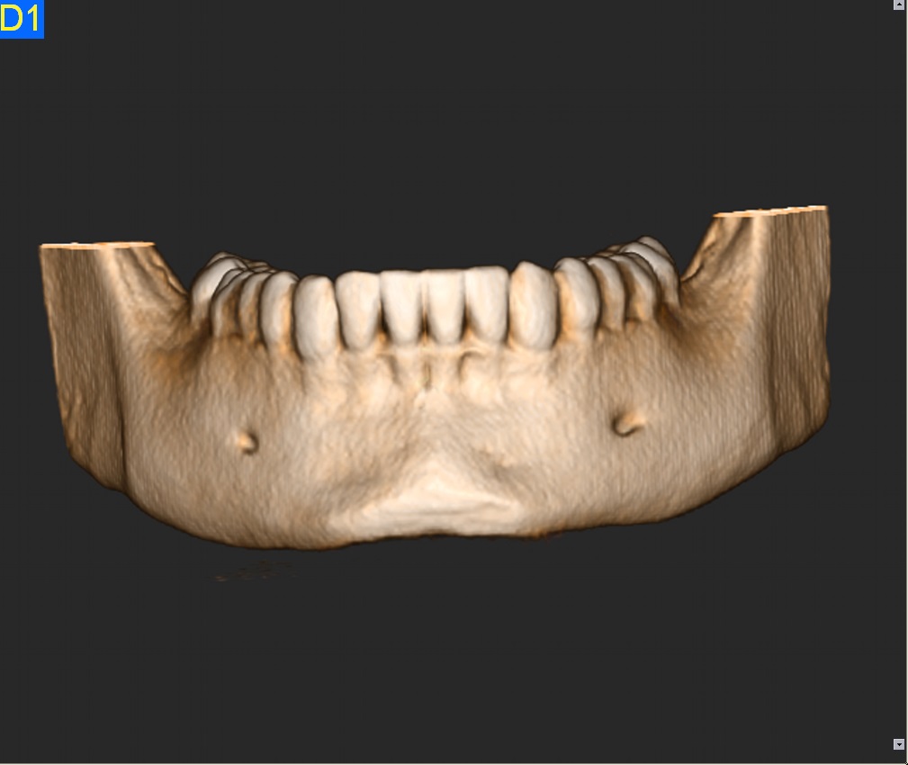 Opleiding CBCT Toezichthoudend Medewerker Stralingsbescherming