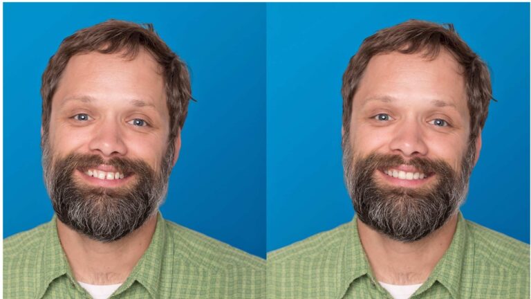 Invisalign Smile Video