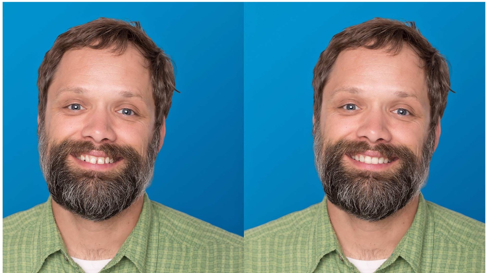 Invisalign Smile Video