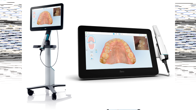 iTero NIRI technology, an interproximal caries detection tool you can trust. An article from a 2021 clinical study validating the significant benefits of the iTero Element 5D imaging systems as an aid in detection and monitoring of interproximal caries