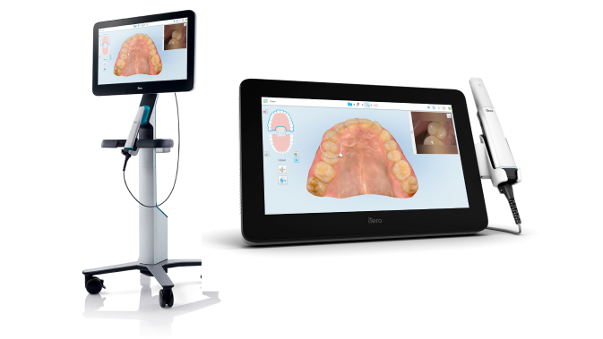 iTero NIRI technology, an interproximal caries detection tool you can trust. An article from a 2021 clinical study validating the significant benefits of the iTero Element 5D imaging systems as an aid in detection and monitoring of interproximal caries