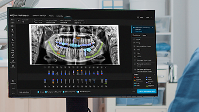 iTero Lumina intraoral scanner