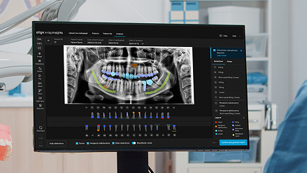 iTero™ intraoral scanners