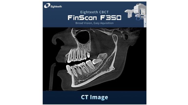 Panoramique Dentaire Eighteeth FinScan F 350