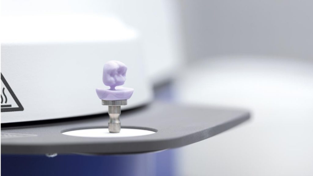 CAD/CAM Chairside – Dentex