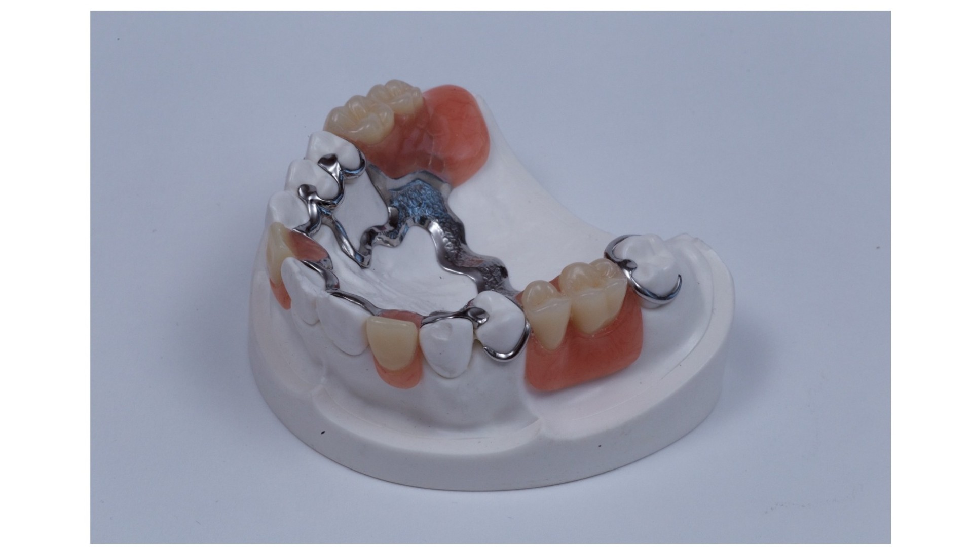 FRAME METAAL KUNSTSTOF