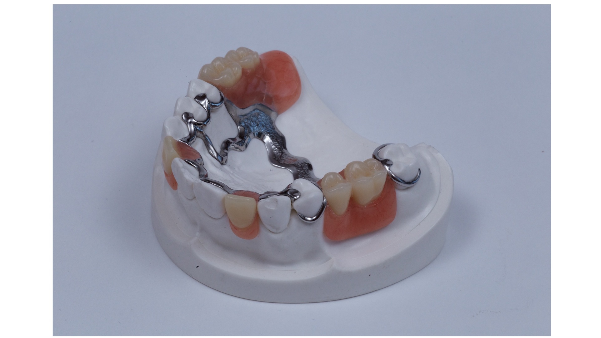 SQUELETTIQUE  METAL RESINE