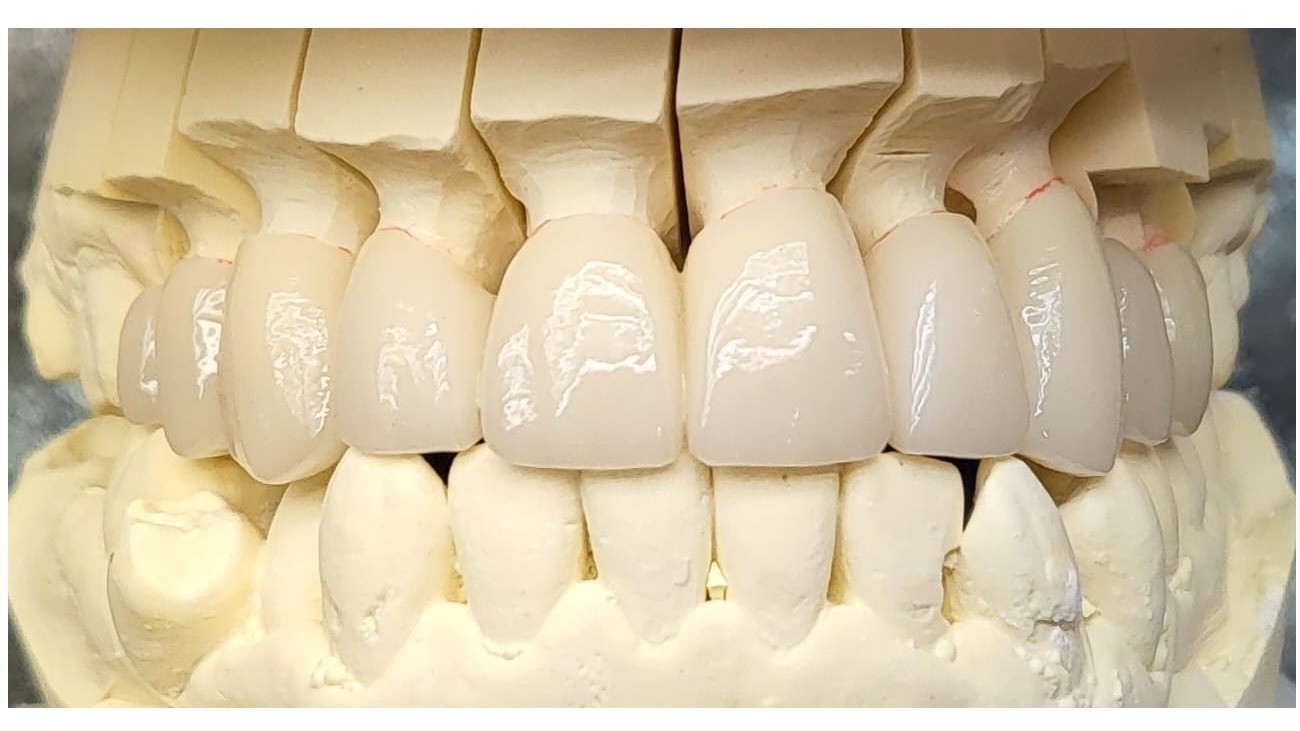 BRIDGE CERAMO ZIRCON