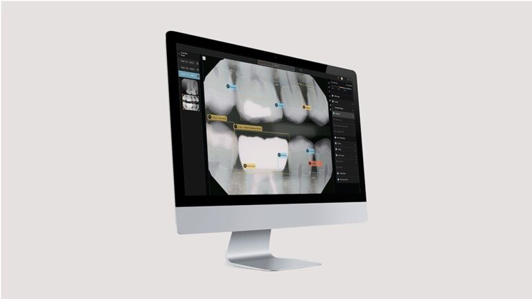 Second Opinion: La première Intelligence Artificielle qui vous aide en temps réel à votre évaluation radiographique.