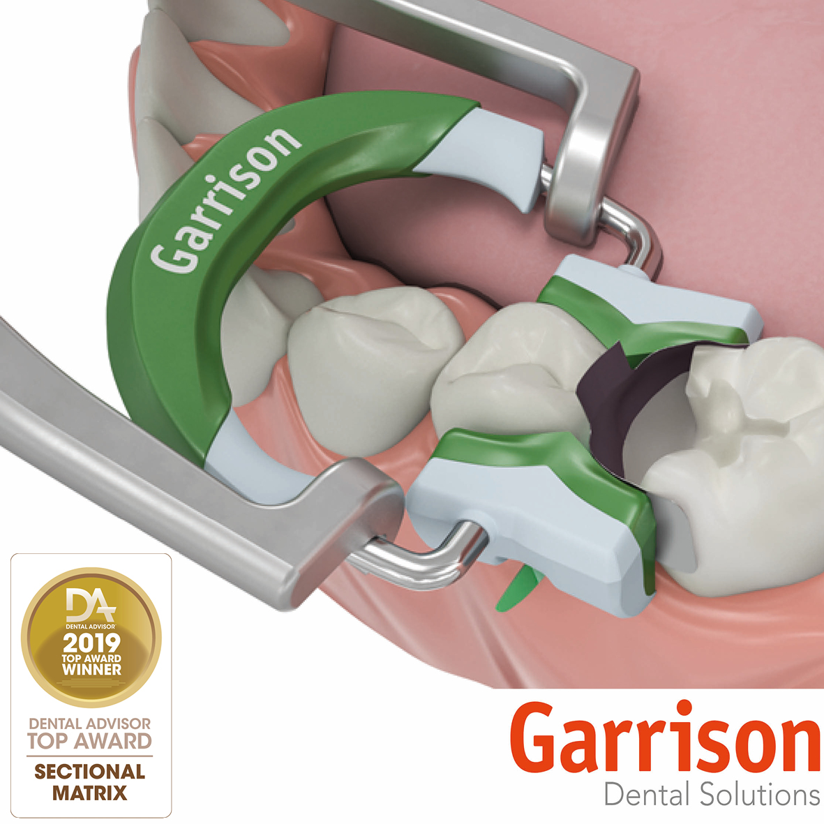 Composi Tight 3D Fusion