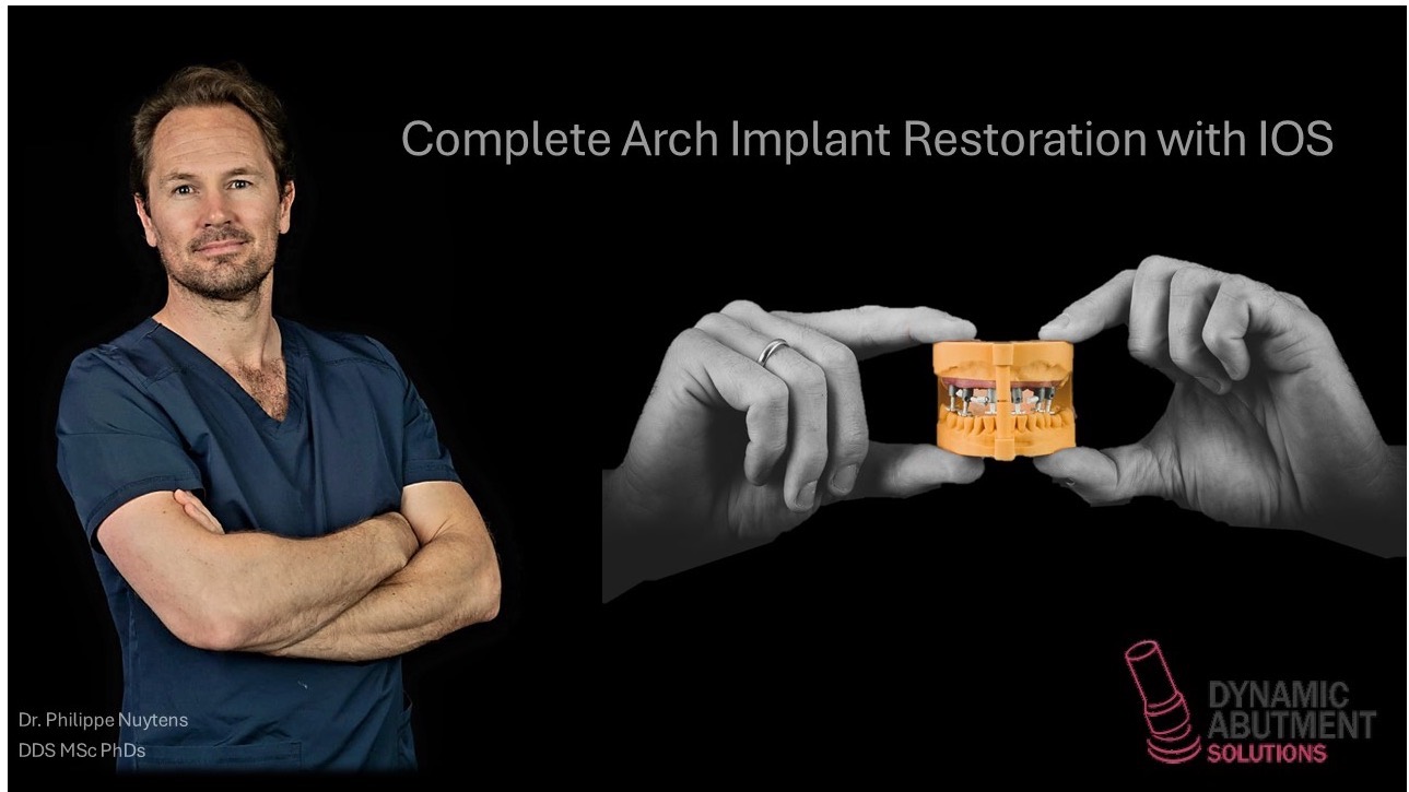 CAPS – Dynamic Abutment Solutions