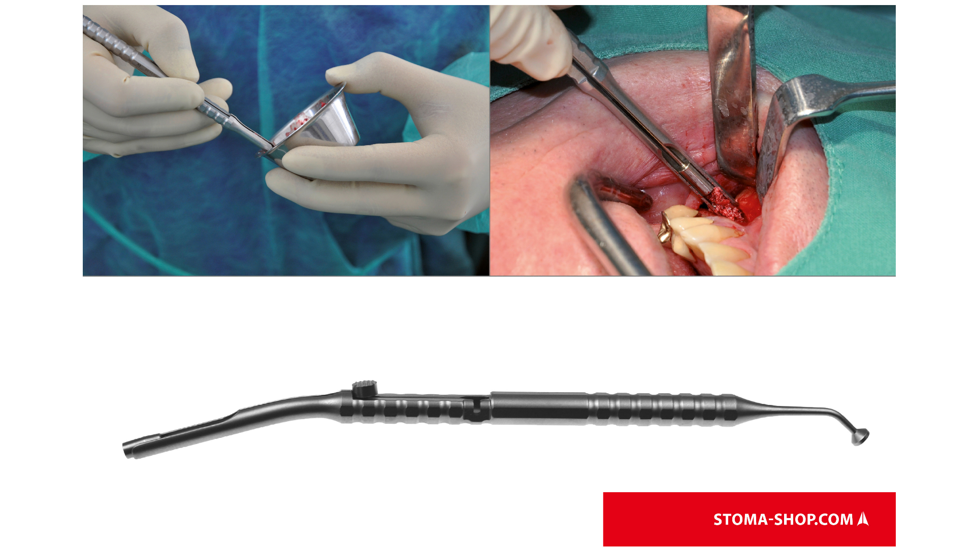 Botapplicator met pusher en compactor, Olsberg