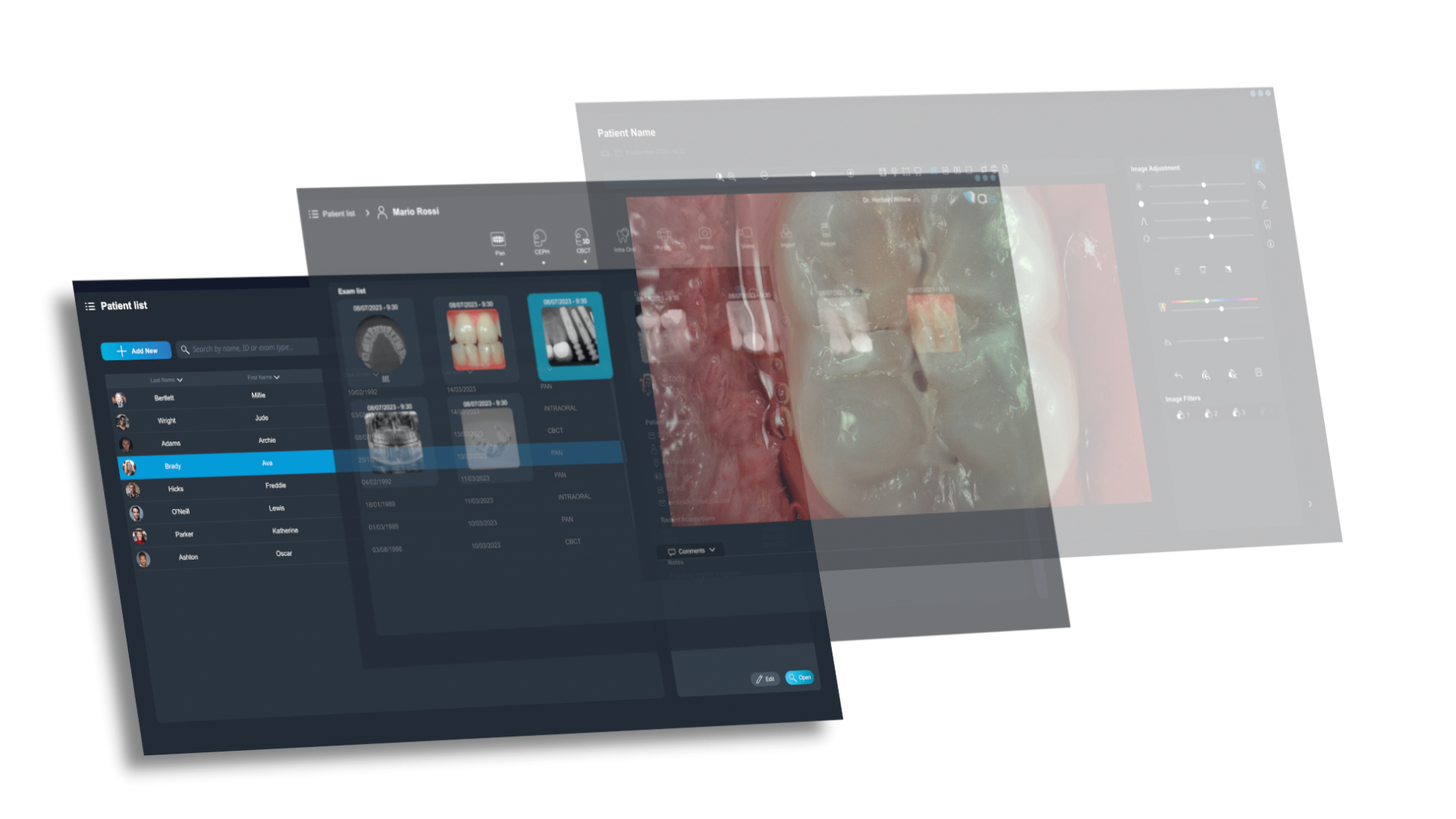 ACTEON Imaging Suite 5 (AIS 5)