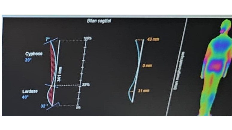 Analyse 3D Statique Kinéod : une vision précise de l’organisation corporelle
