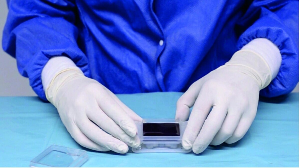 FastSkin® – komplexe Wunden schneller, effizienter und nachhaltiger schliessen.